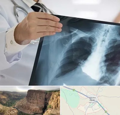 فوق تخصص ریه در سرپل ذهاب