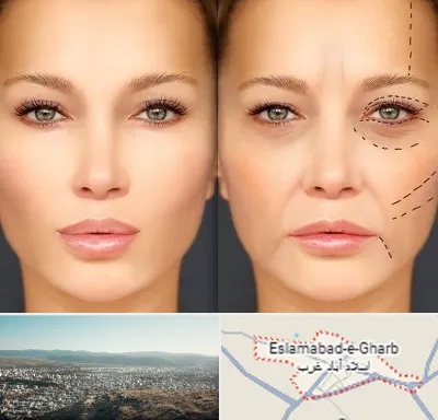 متخصص زیبایی چشم در اسلام آباد غرب