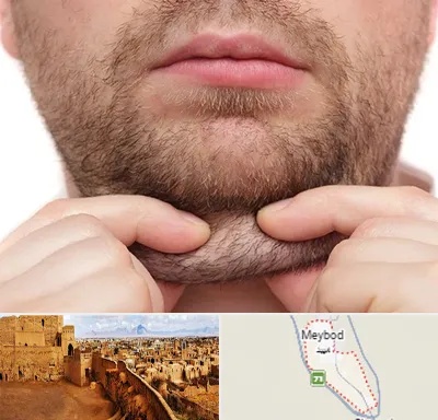 ساکشن غبغب در میبد