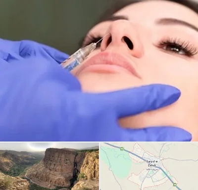 هیالاز در سرپل ذهاب