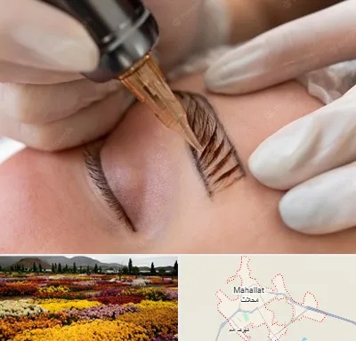میکروبلیدینگ در محلات