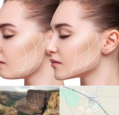 جراحی بوکال فت در سرپل ذهاب