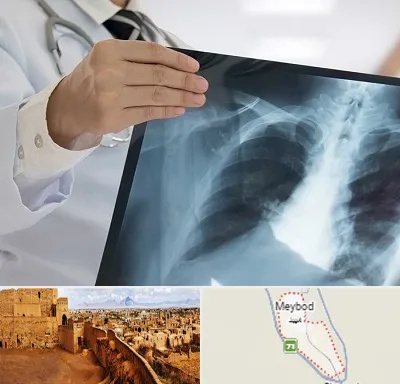 فوق تخصص ریه در میبد
