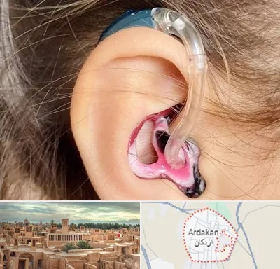 ساخت قالب سمعک در اردکان
