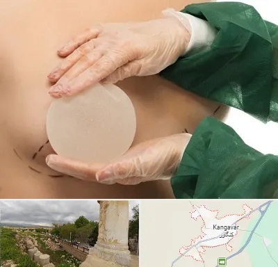 جراحی پروتز سینه در کنگاور