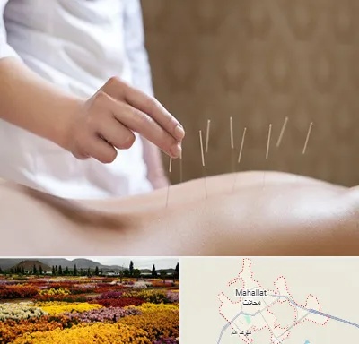 درای نیدلینگ در محلات