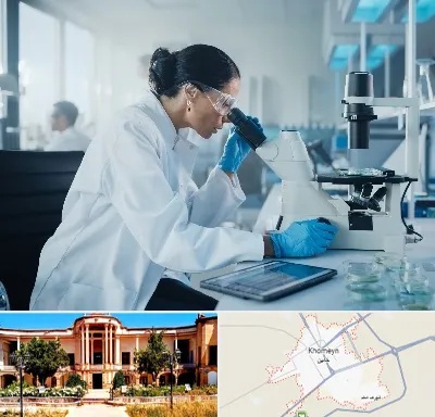 آزمایشگاه HPV در خمین