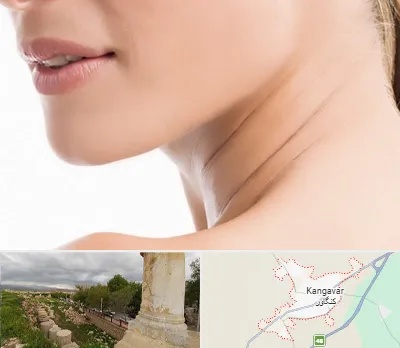 جراحی فک با لیزر در کنگاور