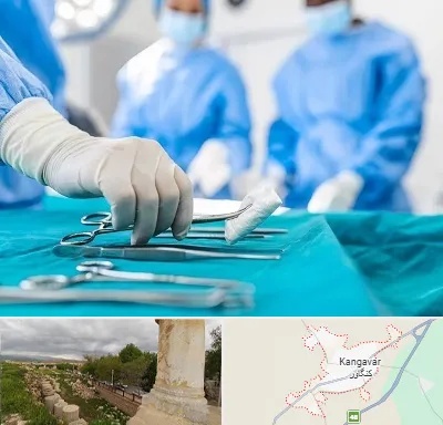 مونس پلاستی در کنگاور