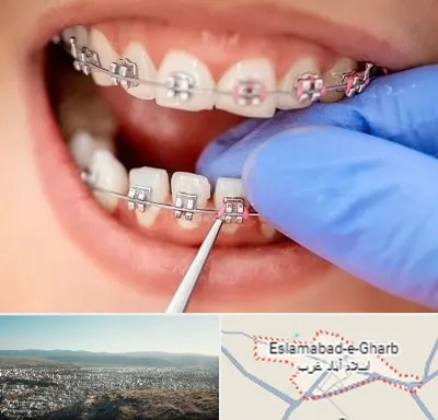 مرکز ارتودنسی دندان در اسلام آباد غرب