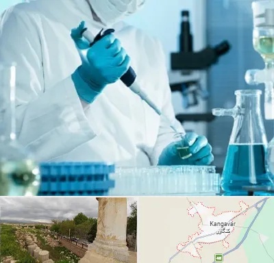 آزمایشگاه HIV در کنگاور