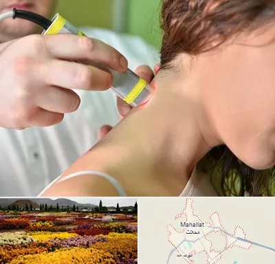 لیزر درمانی در محلات