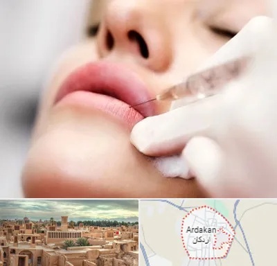 کلینیک تزریق ژل لب در اردکان