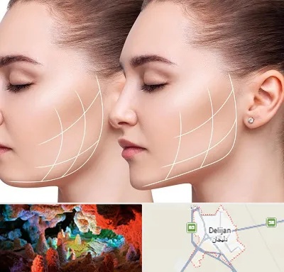 جراحی بوکال فت در دلیجان