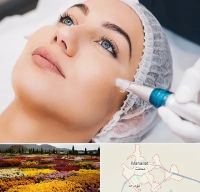 مزونیدلینگ در محلات