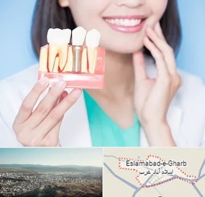 متخصص ایمپلنت در اسلام آباد غرب
