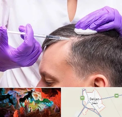 دکتر فوق تخصص پوست و مو در دلیجان