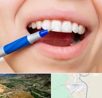 دندانسازی ارزان در اسدآباد