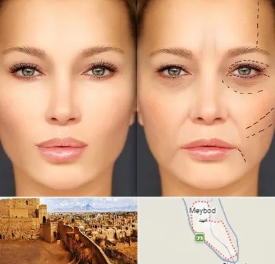 متخصص زیبایی چشم در میبد