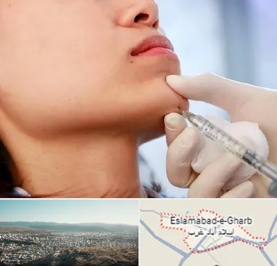 زاویه سازی صورت در اسلام آباد غرب
