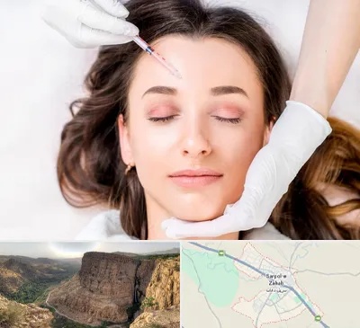 مزوتراپی ابرو در سرپل ذهاب