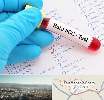 آزمایشگاه بارداری در اسلام آباد غرب