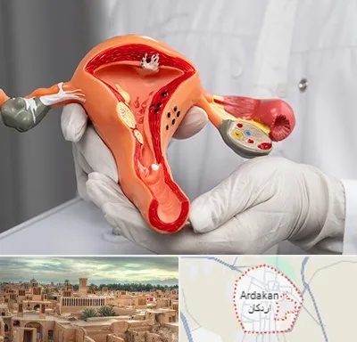 دکتر سرطان رحم در اردکان