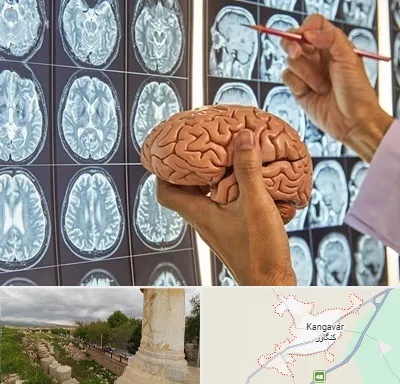 دکتر فوق تخصص جراح مغز و اعصاب در کنگاور