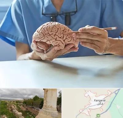 دکتر نورولوژی در کنگاور