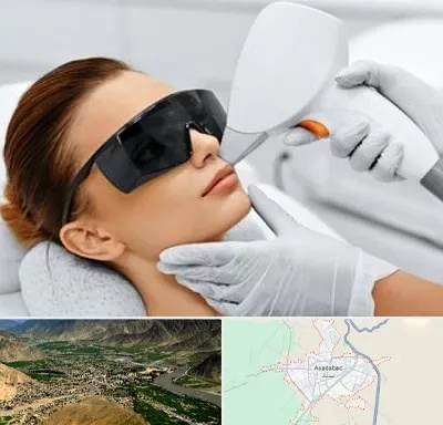 مرکز لیزر مو در اسدآباد