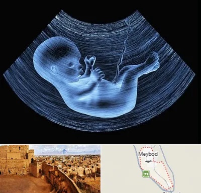 دکتر متخصص غربال گری در میبد
