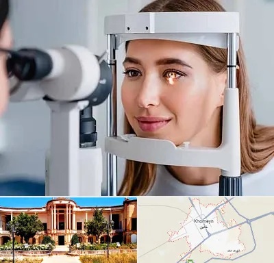 دکتر قوز قرنیه در خمین