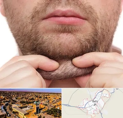 ساکشن غبغب در بافق