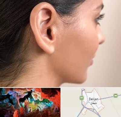 عمل گوش بل در دلیجان