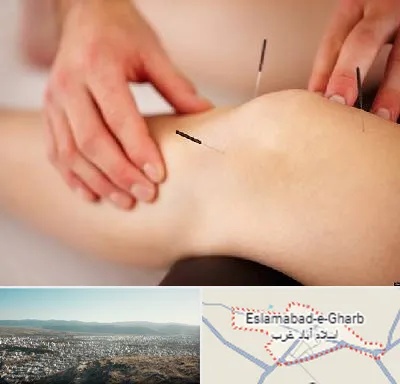 دکتر طب سوزنی برای لاغری در اسلام آباد غرب