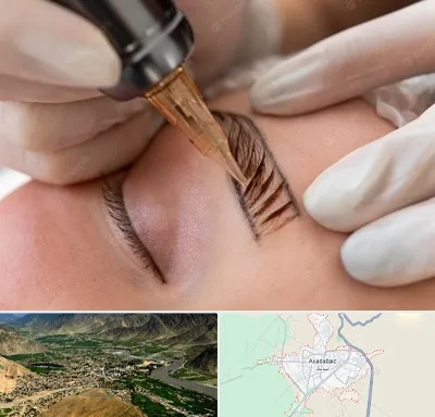 میکروبلیدینگ در اسدآباد