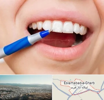 دندانسازی ارزان در اسلام آباد غرب