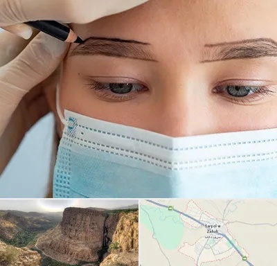 کاشت ابرو در سرپل ذهاب