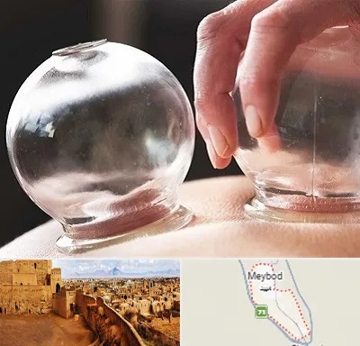 مرکز حجامت در میبد