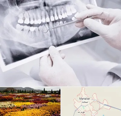 رادیولوژی دهان و دندان در محلات