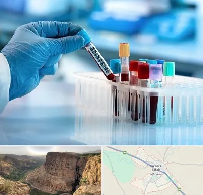 آزمایشگاه خون قبل از ازدواج در سرپل ذهاب