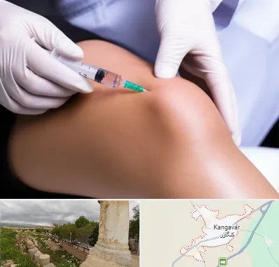 پلاسما درمانی PRP در کنگاور