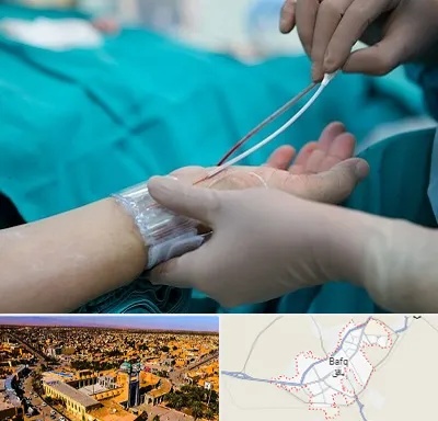 آنژیوگرافی در بافق