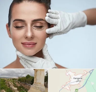 عمل پف چشم در کنگاور