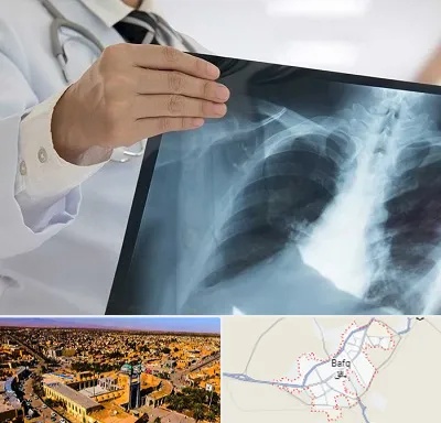 فوق تخصص ریه در بافق