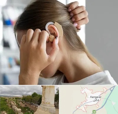 فروش اقساطی سمعک در کنگاور