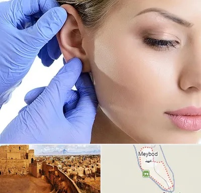اتوپلاستی در میبد