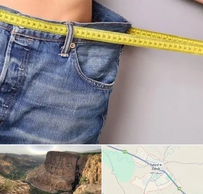 عمل لیپوماتیک در سرپل ذهاب
