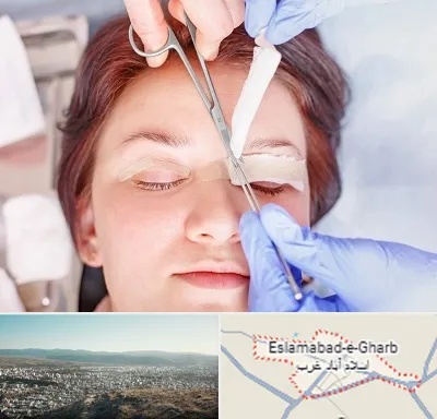 جراحی پلک افتاده در اسلام آباد غرب