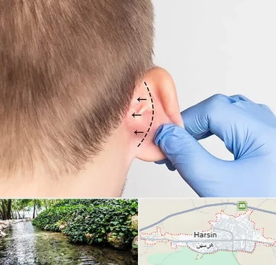 عمل زیبایی گوش در هرسین